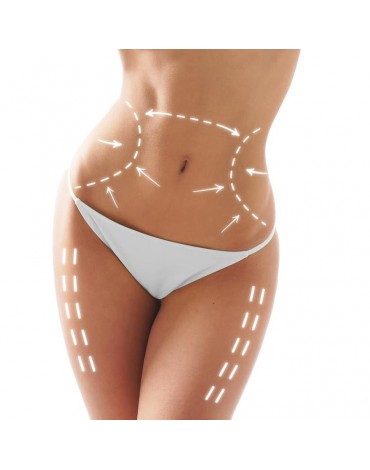 Body liposuction with vaser