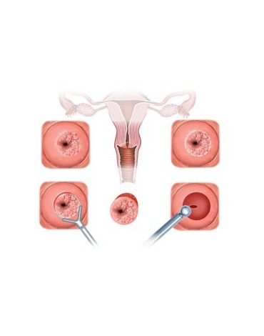 Patología cervical