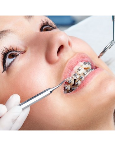 Consulta odontológica (diagnostico odontológico)