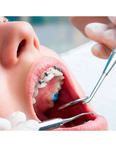 Dental consultation (dental diagnosis)