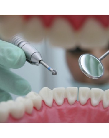 Premolars endodontics (birradiculares)