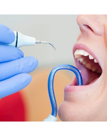 Limpieza dental (profiláctica dental)