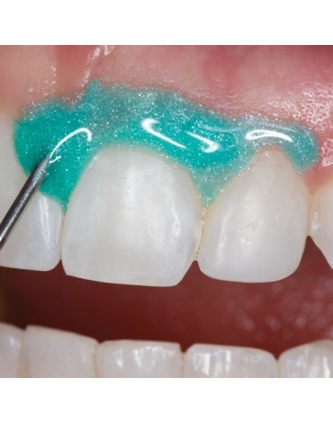Intracoronal whitening by appointment