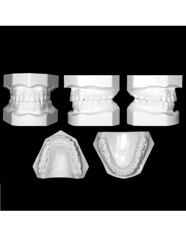 Study models (replica of the dental structure)