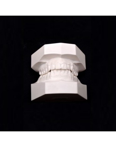 Study models (replica of the dental structure)