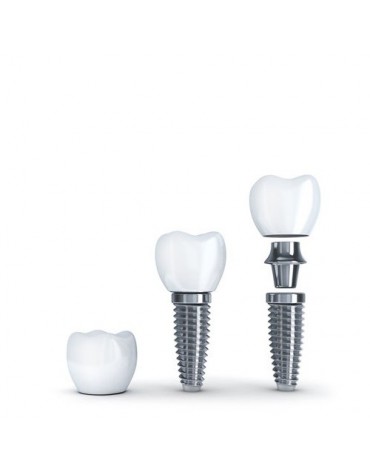 Crown on implants (Implanted Crown)