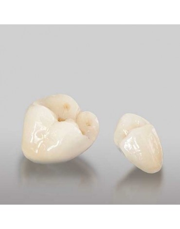 Corona de Porcelana (funda de porcelana)