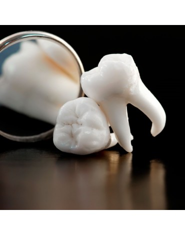 Exodoncia (extracción dental)