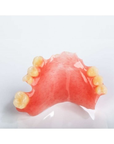 Prótesis parcial (dientes postizos parciales)  