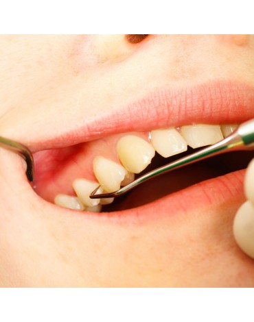 Profilaxis dental   (tratamiento dental preventivo)   