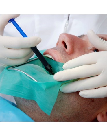 Endodoncia  anterior unirradicular (tratamiento de nervio en dientes anteriores de una raíz) 