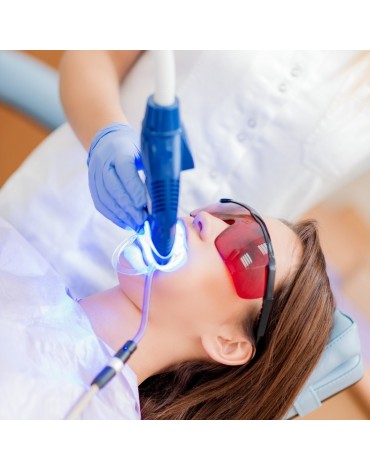 Blanqueamiento dental con láser
