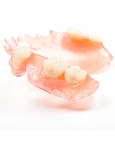 Immediate acrylic removable partial prosthesis