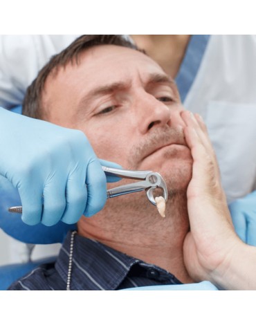 Exodoncia (extracción dental)   