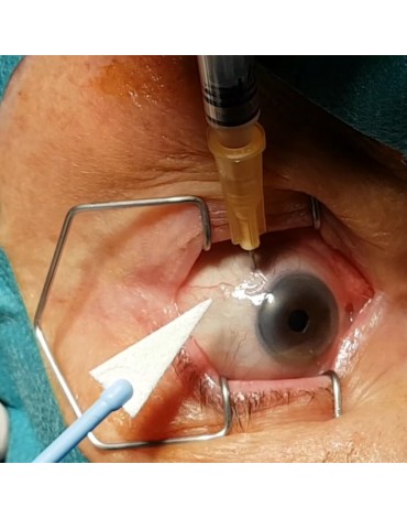 Intravitreal injection for diabetic retinopathy with Eylea medication