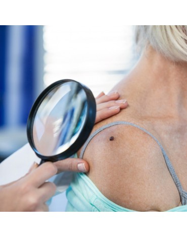 Diagnosis and treatment of skin cancer