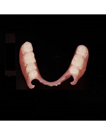 Prótesis parcial removible acrílica