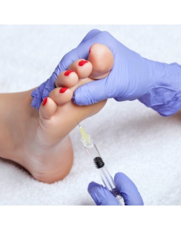 Application of platelet-rich plasma in the heel