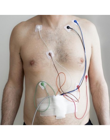 Ambulatory Electrocardiography or Holter 48 hours