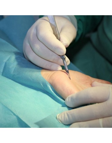 Carpal tunnel surgery