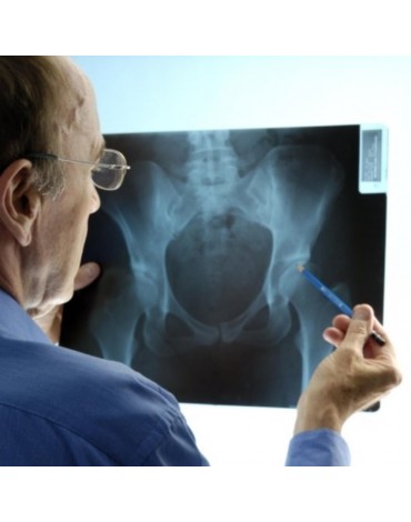 Radiografía de cadera ap