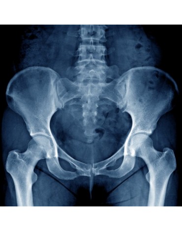 X-ray of the axial hip