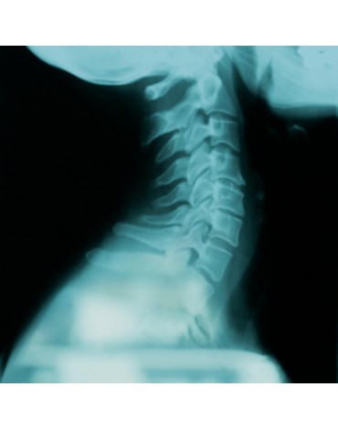 Radiografía de columna cervical ap / lat / oblicua y dinámica