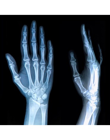 Wrist x-ray