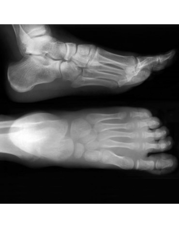 Foot x-ray with support