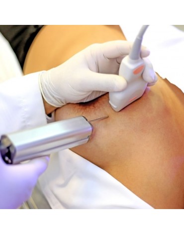 Tru – Cut de mamas (biopsia con aguja gruesa)