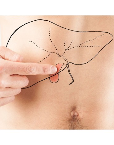 Cholecystectomy