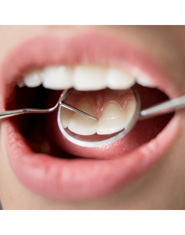 Dental cleaning (dental prophylaxis)