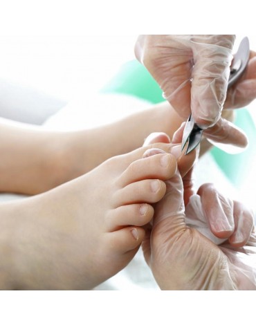 Extraction of ingrown toenail