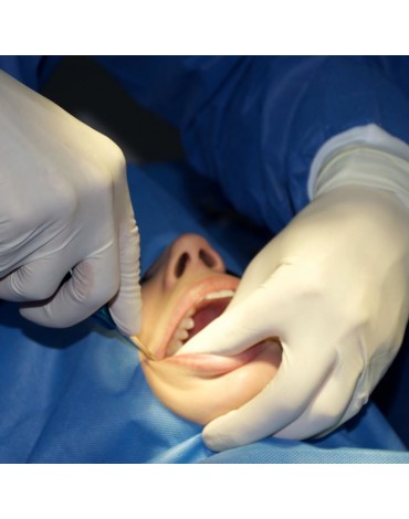 Third Molar Impacted Surgery (surgery for unexplored cords)