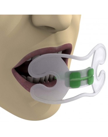 Thermo-cured acrylic bite plane (thermo-cured acrylic repositioning plate)