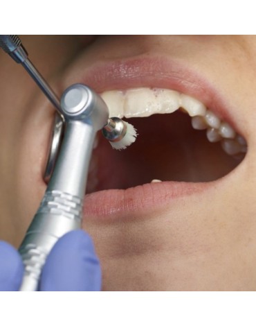 Profilaxis dental   (tratamiento dental preventivo)