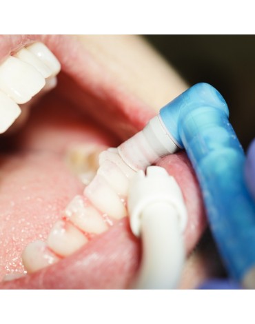 Dental prophylaxis (preventive dental treatment)