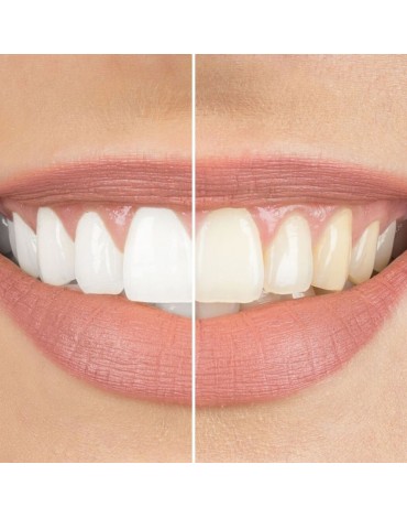 Whitening