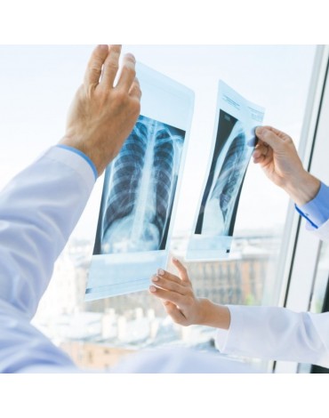 Radiografía de columna dorsal