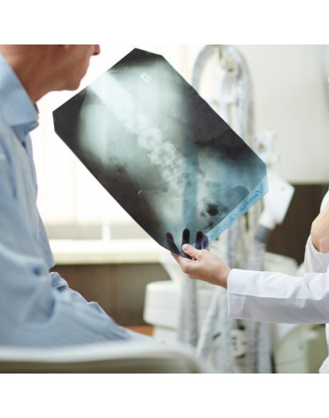 X-ray of lumbar column