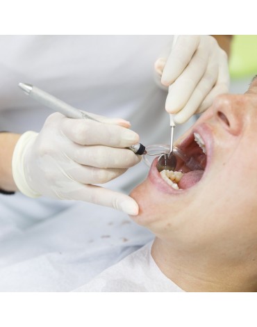 Birradicular premolar endodontics (nerve treatment in two-root teeth)