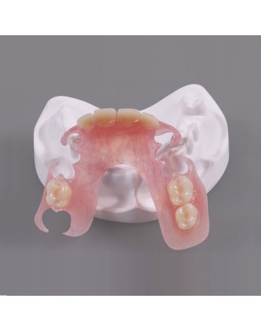 Immediate Acrylic Removable Partial Prosthesis (Immediate Acrylic Removable Partial Dentures)