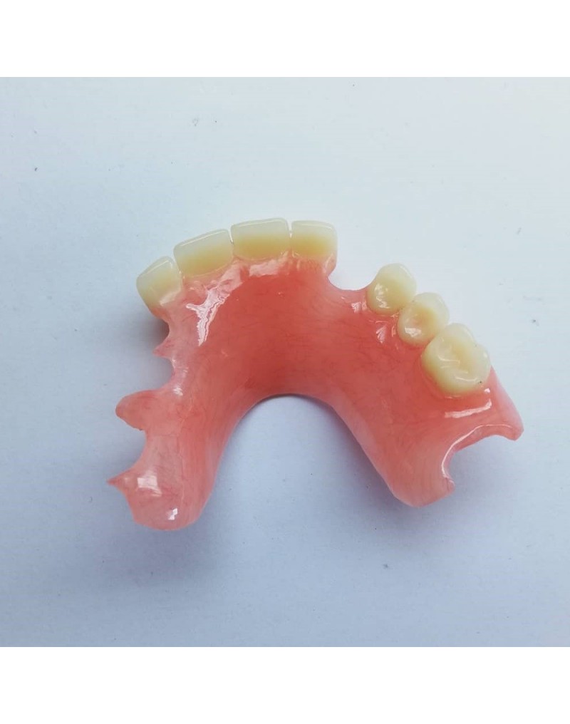 removable partial dentures