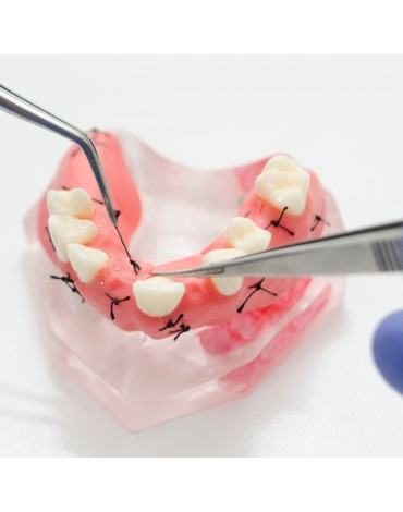 Sutura heridas mucosa oral (cosido herida mucosa oral)