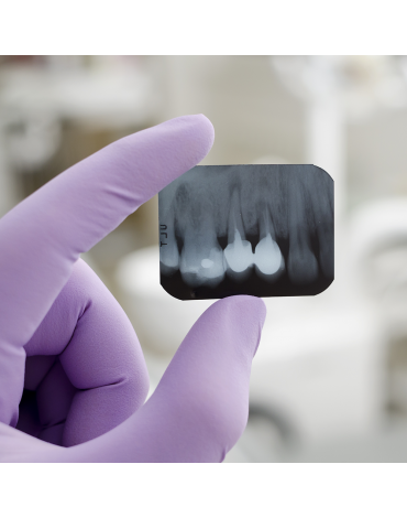 Periapical radiography (intrabuccal plate)
