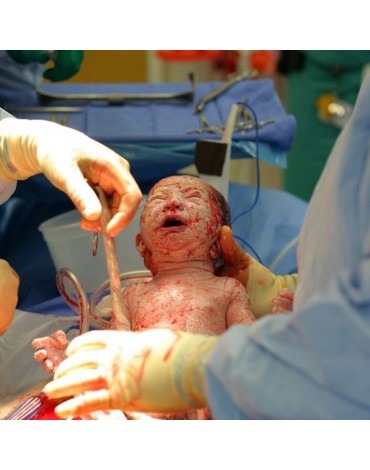 Cesarean