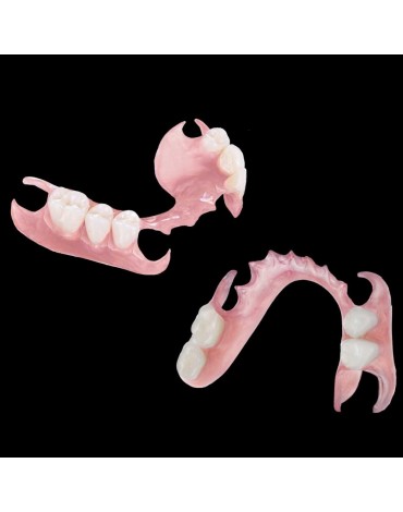 Acrylic removable partial denture (acrylic removable partial denture)
