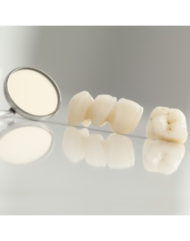 Fixed dental prosthesis with zirconium (per unit)