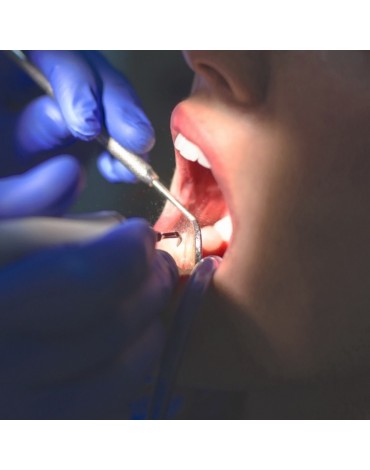Limpieza dental con ultrasonido (tartrectomía)  
