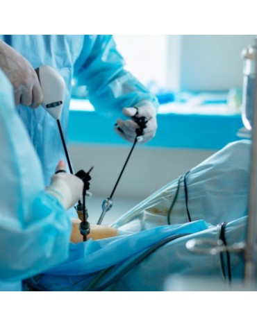 Cirugía etapificadora para el cáncer de endometrio por vía laparoscopica